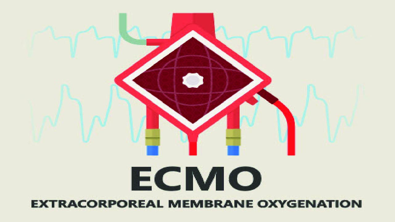 Management and Troubleshooting of ECMO Complications